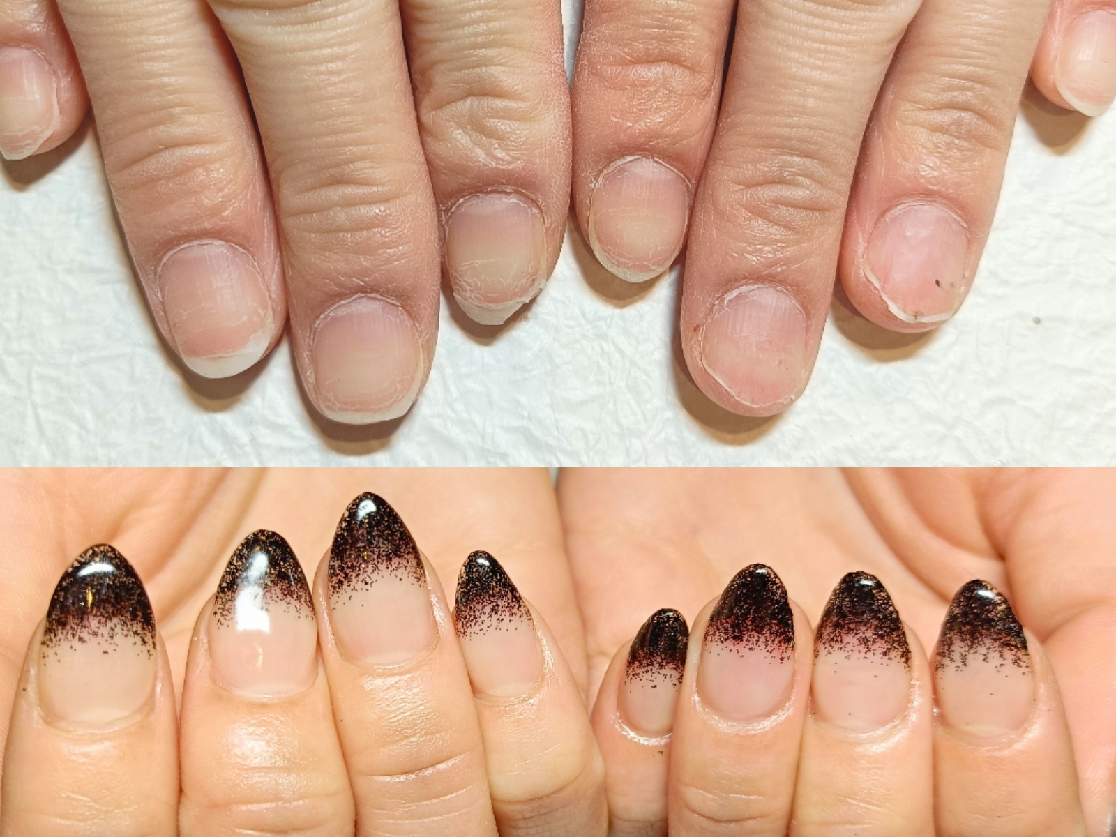 セルフネイルで傷んだお爪を深爪矯正で美爪育成します