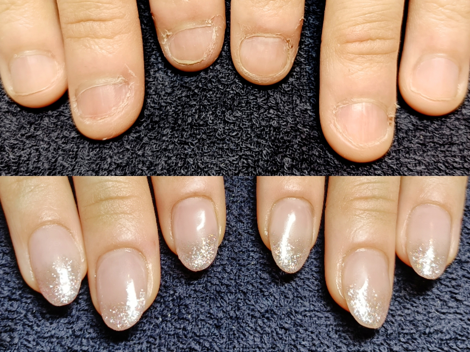 深爪緩和のアクリルスカルプが3週間が持ちました！ネイルの持ちが良いと自爪も健康に育ちます。