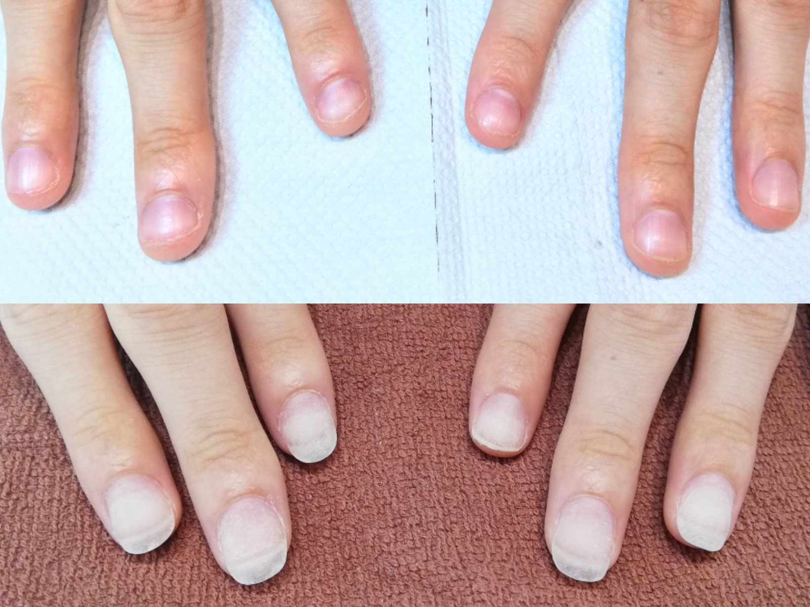 【深爪緩和】自爪を強く美しくお客様の2ヶ月間の自爪育成をまとめました。