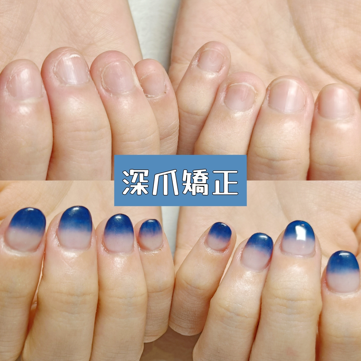 弱爪革命！ネイルで自爪を育てる新常識