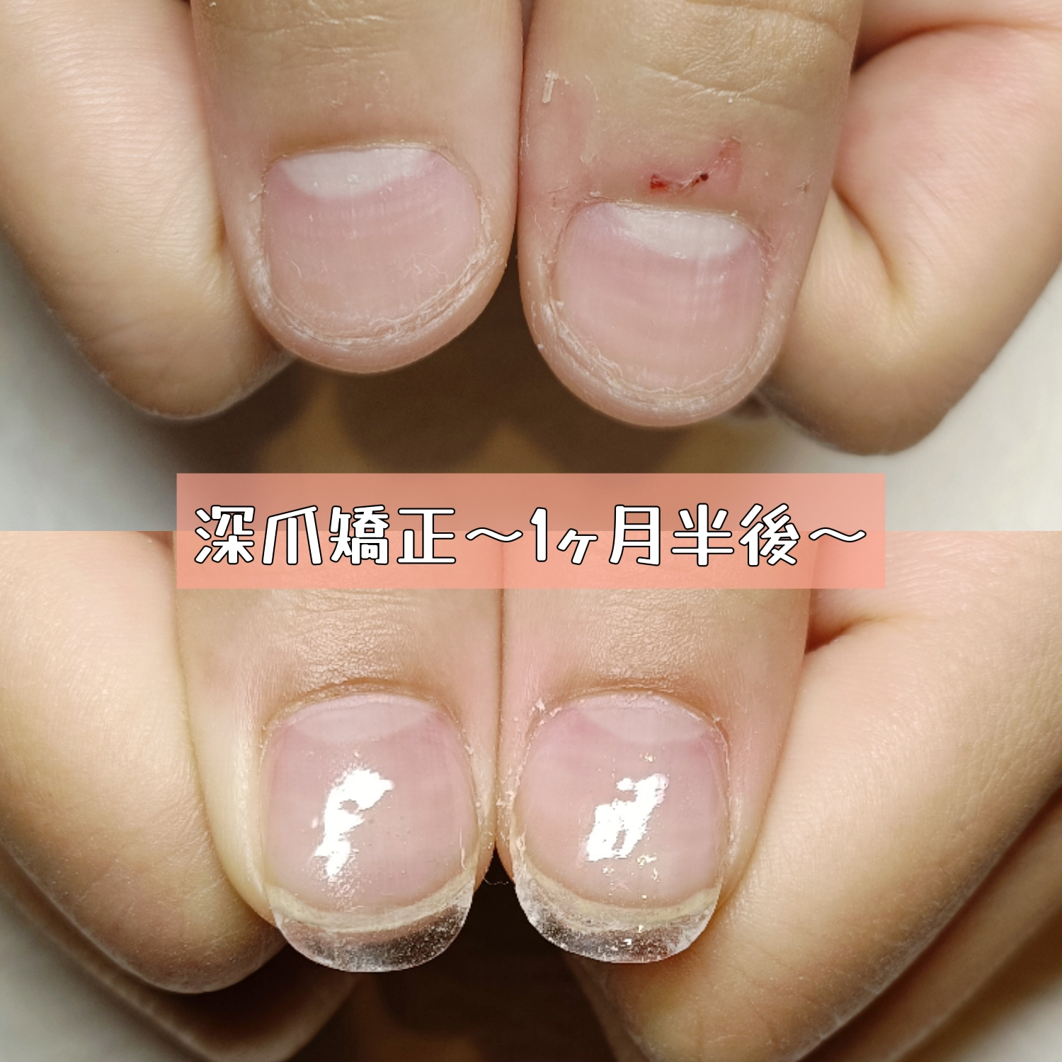 1000007166.jpg