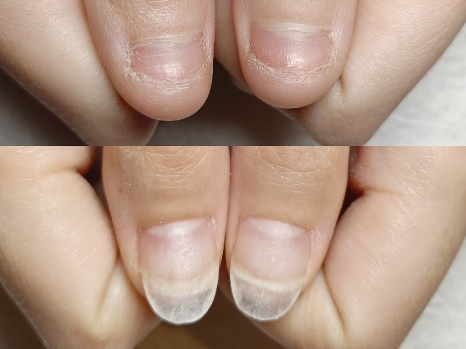 【深爪矯正の成果は3週間後！】お客様と一緒に美爪育成するネイルサロン