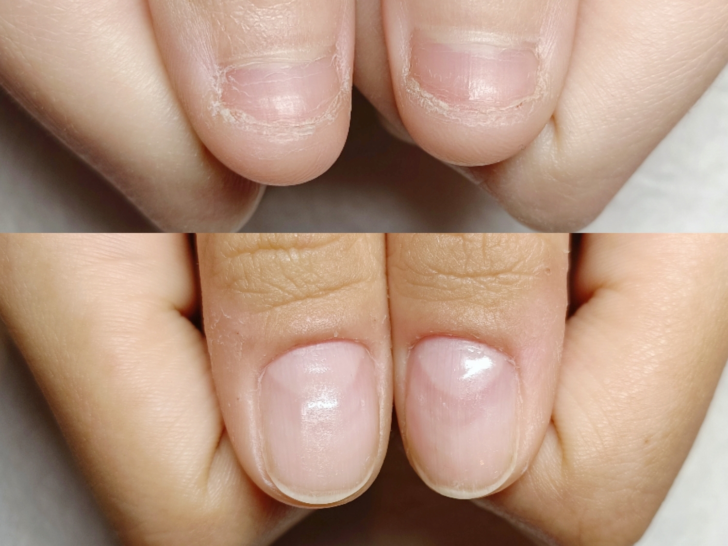 自爪育成は女性を幸せにする/深爪矯正/丁寧ネイルケア