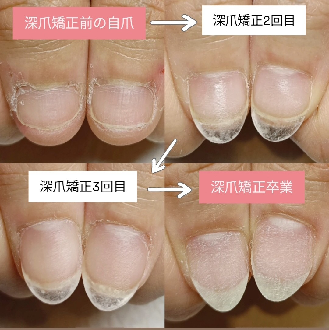 BeautyPlus_20250702125546120_save.jpg