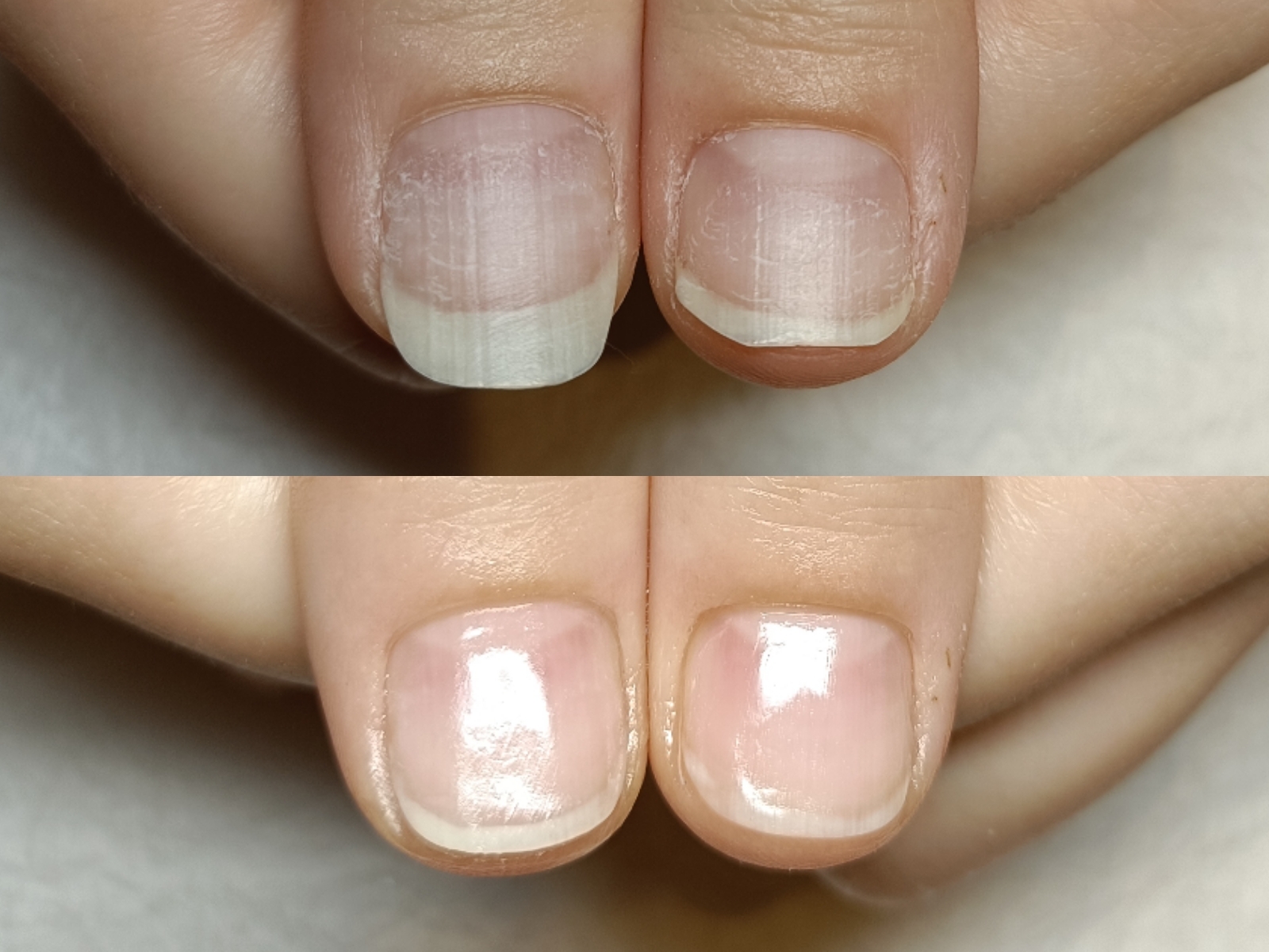 爪の健康と美しさを大切にする爪再生のネイルサロン