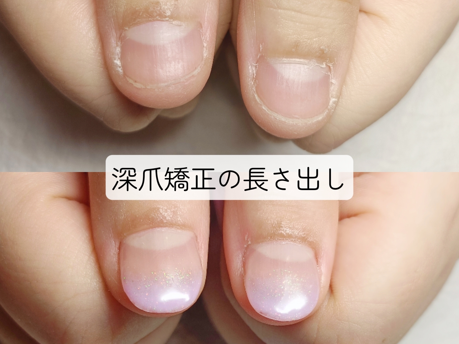 深爪を卒業して、自分らしい指先へ