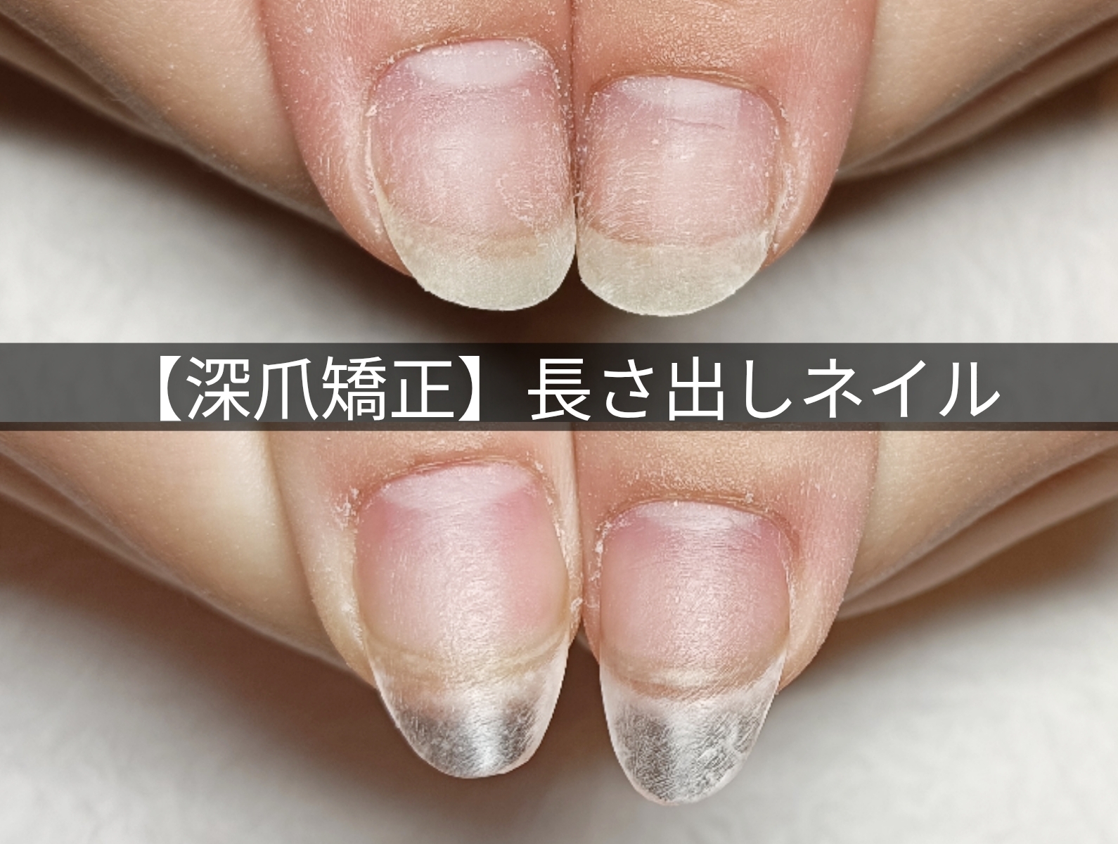 短い爪も大丈夫。自爪を育てる"やさしい長さ出し