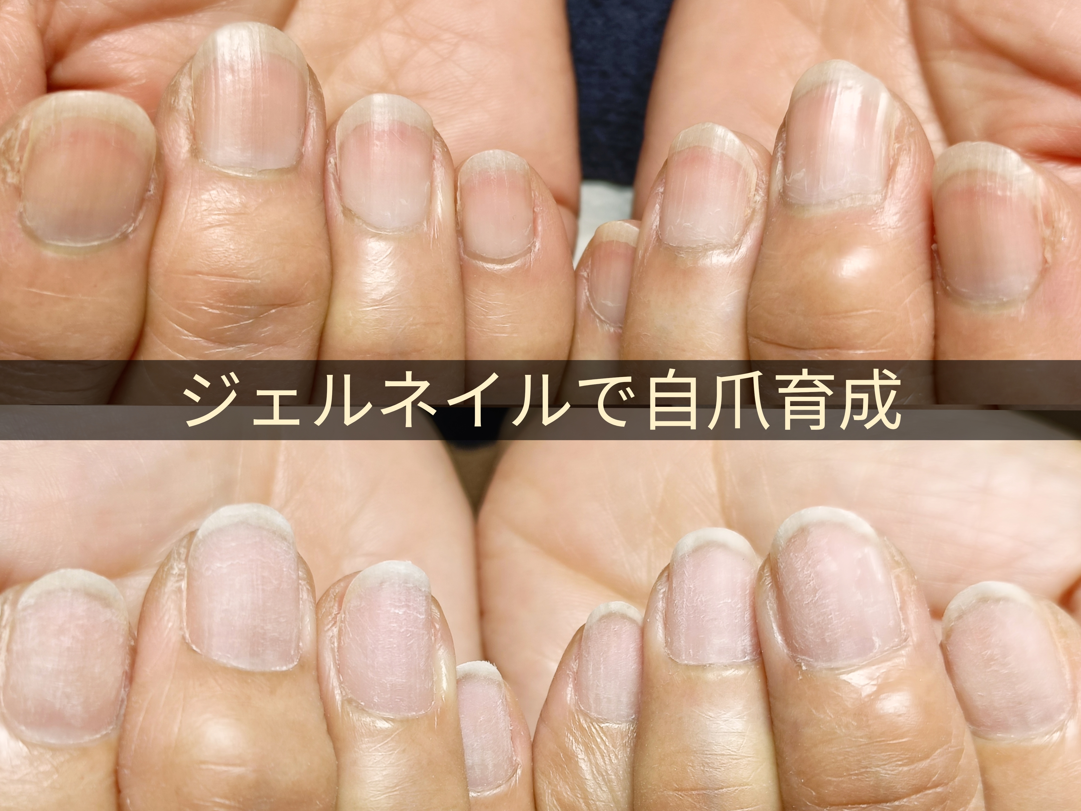 私の爪がジェルネイルで、輝く自信に変わるまで