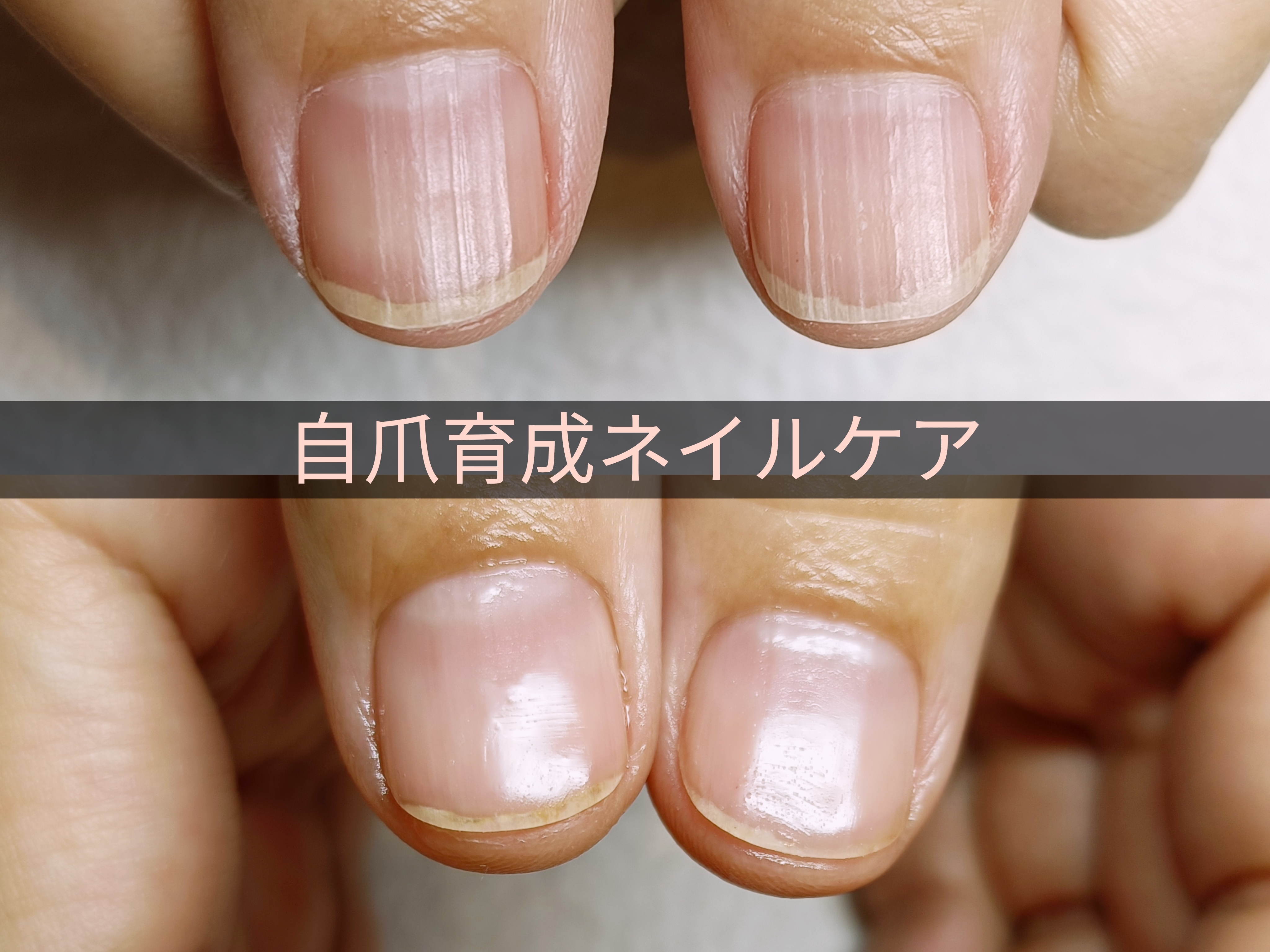 爪の縦筋は体からのサイン？栄養で内側から美しく♪
