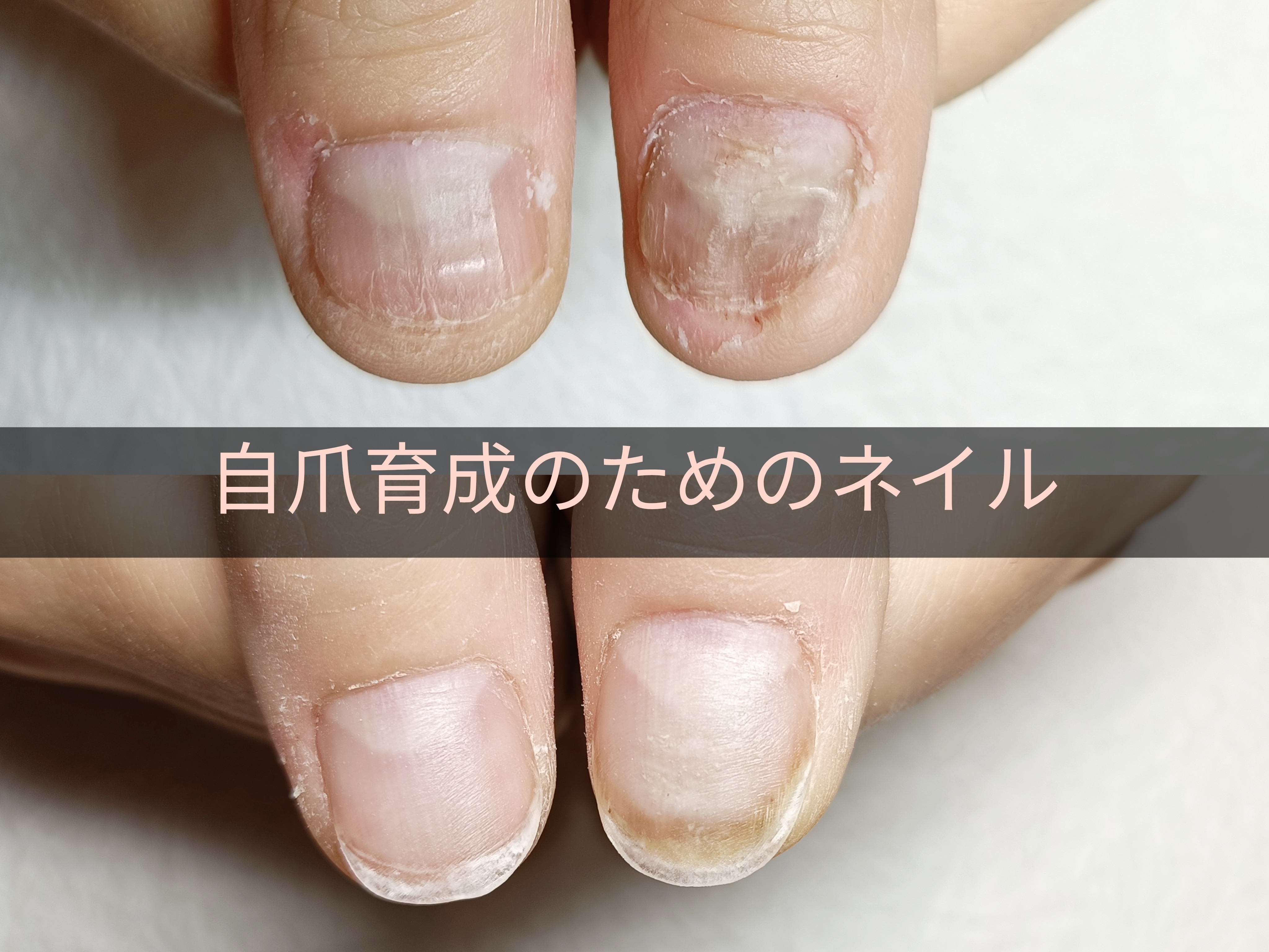 ジェルネイルで自爪育成も可能です♪