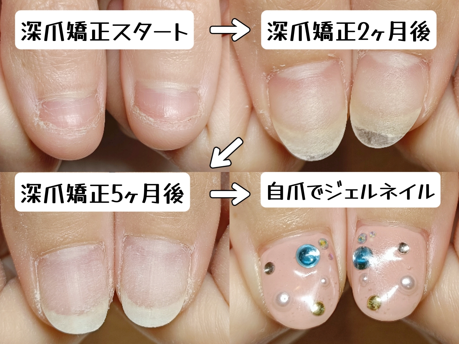 自爪育成は、毎日を丁寧に生きること